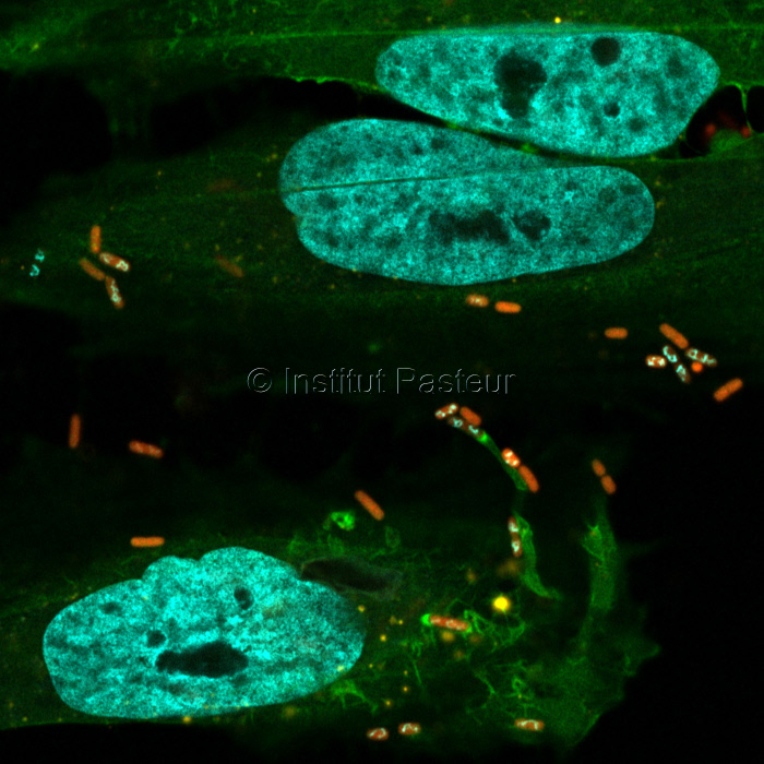Shigella flexneri infectant des cellules Hela