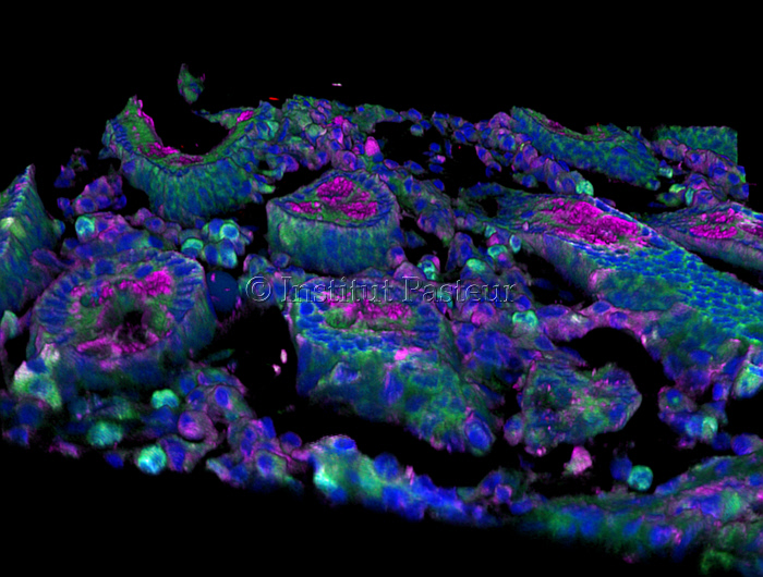 Cellules intestinales produisant une cytokine conférant une protection contre le sida au singe vert d'Afrique infecté par le SIV