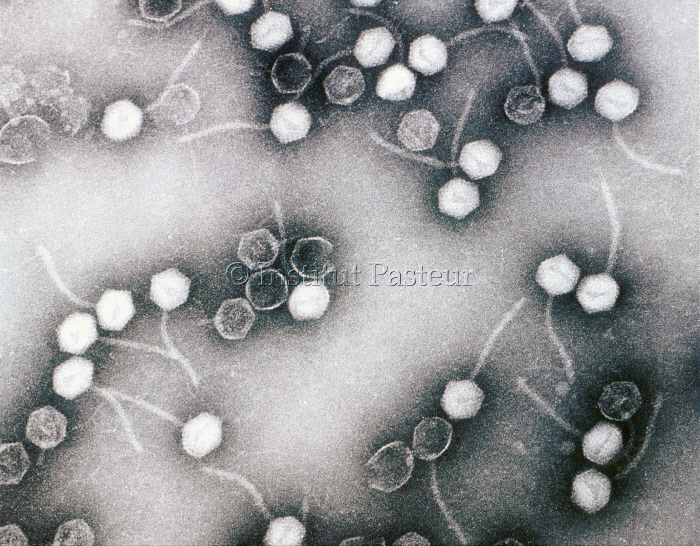 Bactériophages d'Escherichia coli en microscopie électronique.