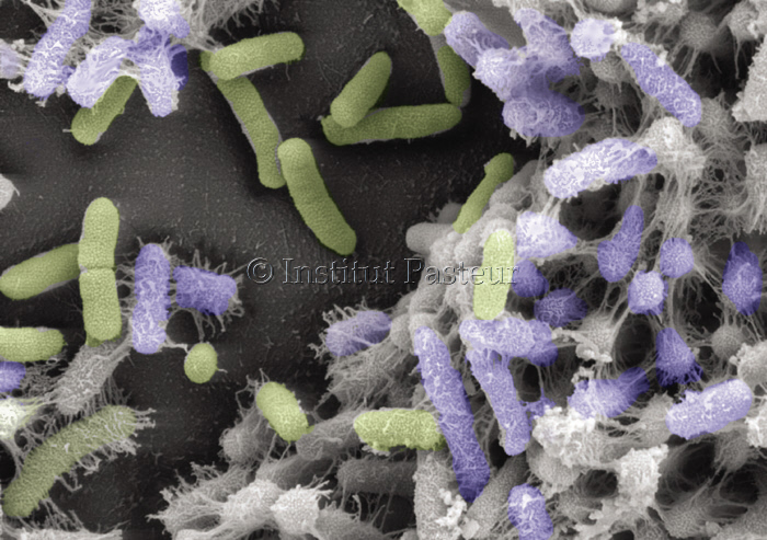 Biofilm de bactéries Escherichia coli se développant sur une surface de verre