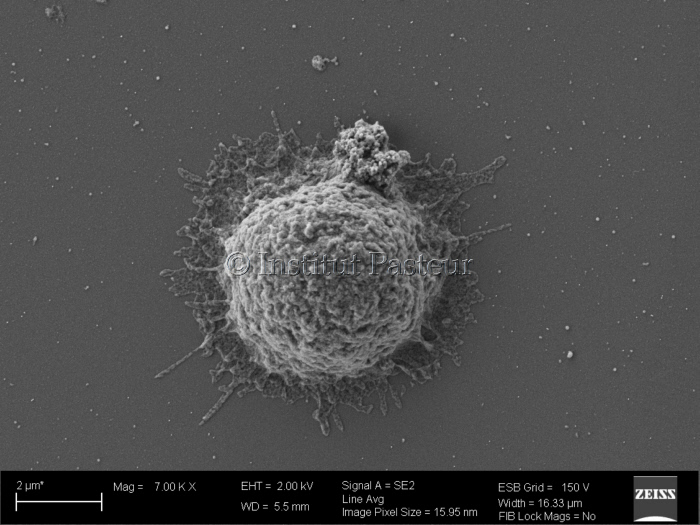 Biofilm viral produit par un lymphocyte T de patient infecté par le VIH-1, visualisé  par microscopie électronique à balayage