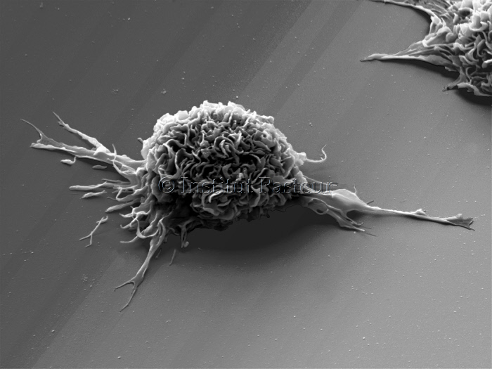 Cellule dendritique vue en microscopie électronique à balayage