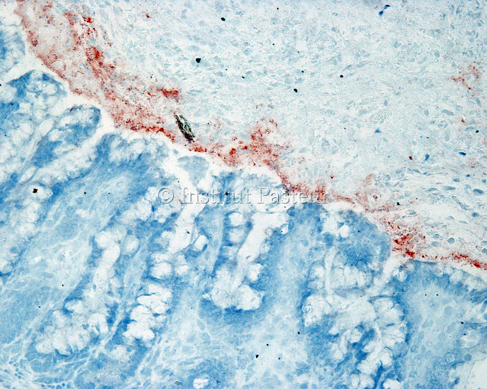 Coupe histologique de tissu intestinal humain immuno-marqué pour la bêta-défensine-3