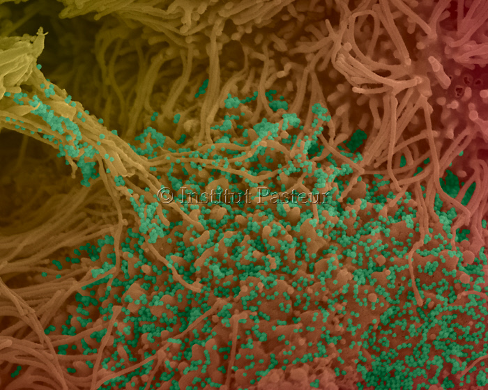 Cellules bronchiques humaines infectées par SARS-CoV-2