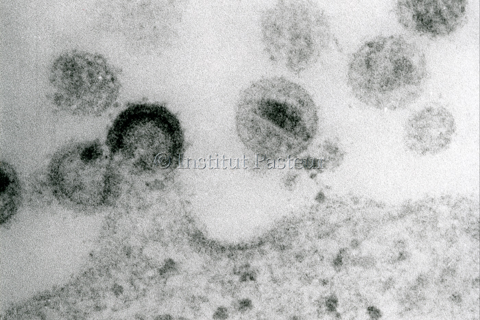 Virus VIH-2 bourgeonnant à la surface d'un lymphocyte