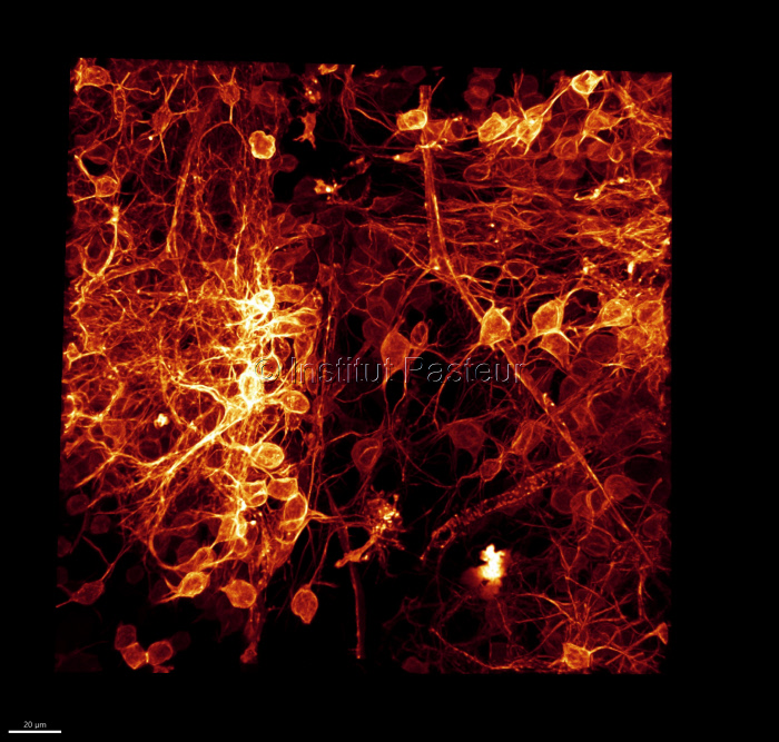 Neurones dans le cerveau du poisson zèbre (microscopie confocale)