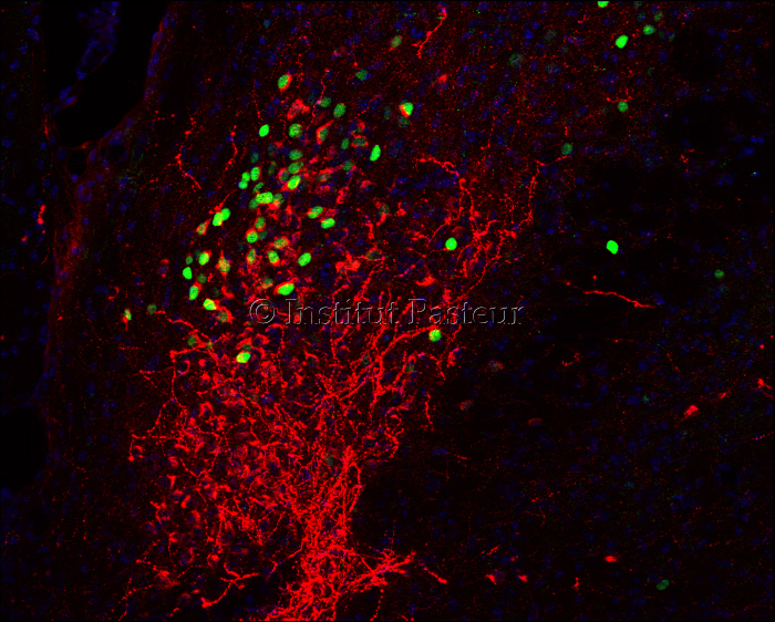 Les neurones d'alarme du noyau parabrachial du cerveau