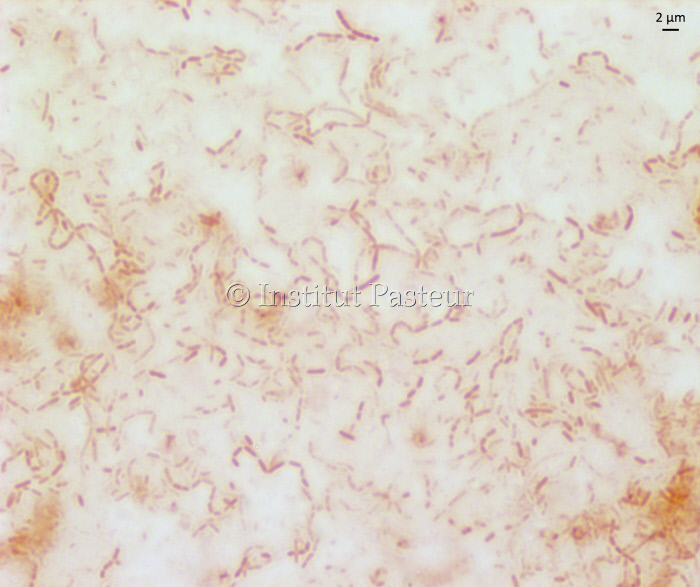 Ruminococcus lactaris en microscopie optique