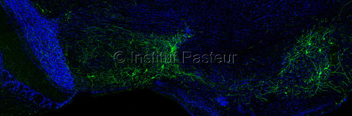 Neurones inhibiteurs (en vert) découverts dans le système olfactif