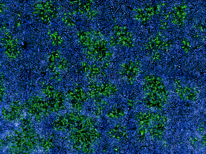 Cellules humaines infectées par MPXV (en vert)