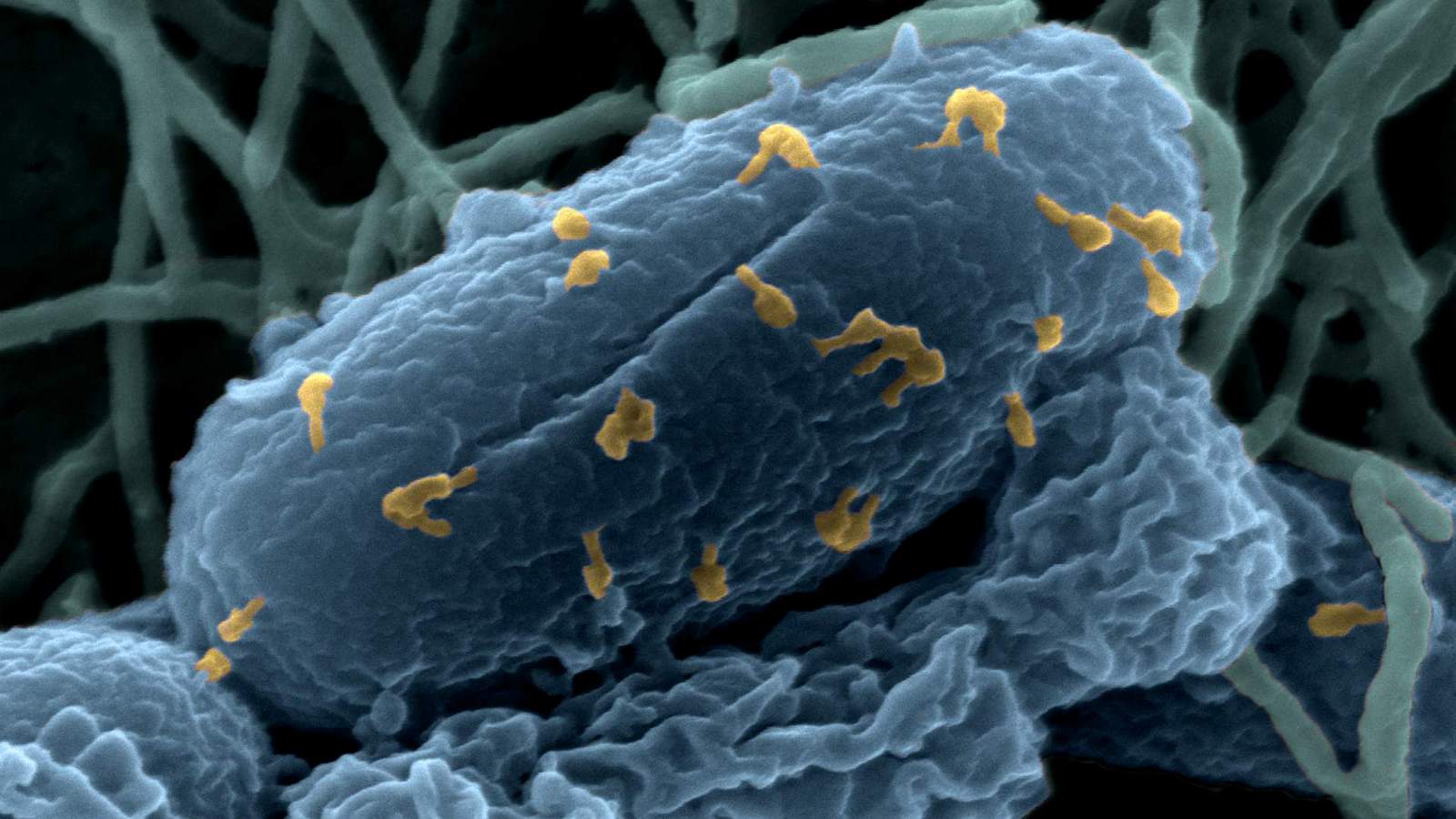 Interactions entre des bactériophages et une souche pathogène de la bactérie Escherichia coli. Image acquise par microscopie électronique à balayage.